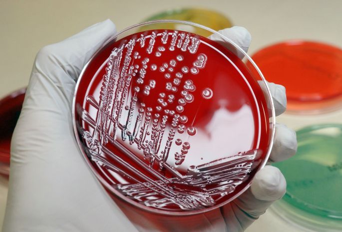 antibiotic-resistant-infections-are-a-major-global-health-threat-thats-killing-millions-scientists-say.jpg