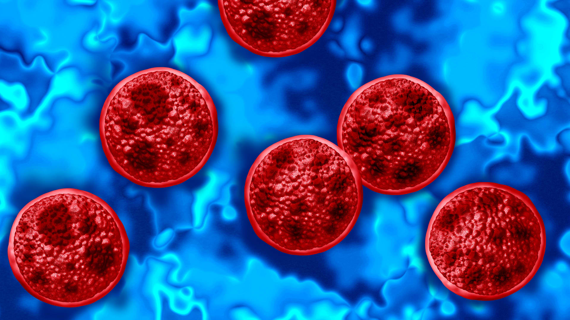 Cyclospora Outbreak Warning: Michigan Reports Fatalities, Food Supply Chain Under Scrutiny featured image
