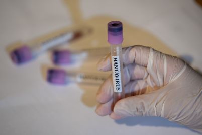 cdc-says-there-are-no-u-s-hantavirus-cases-currently-41-people-being-monitored.jpg