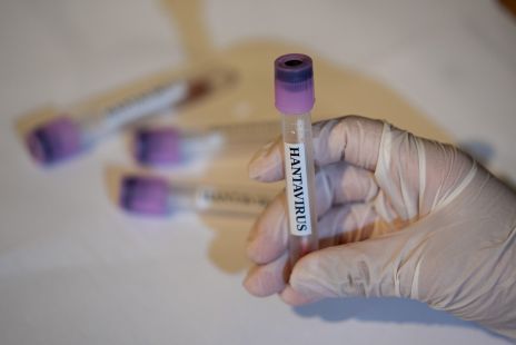 cdc-says-there-are-no-u-s-hantavirus-cases-currently-41-people-being-monitored.jpg