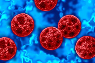 cyclospora-outbreak-warning-michigan-reports-fatalities-food-supply-chain-under-scrutiny.jpg