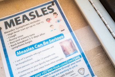 measles-resurgence-a-critical-warning-for-u.s.-public-health-strategy.jpg