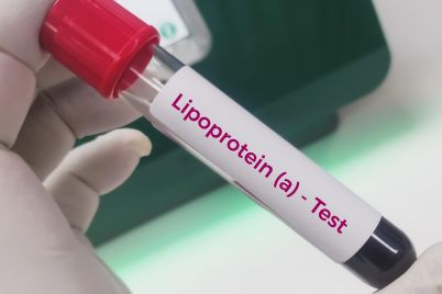 pharma-bets-a-little-known-form-of-cholesterol-will-underpin-its-next-blockbuster-heart-drugs.jpg